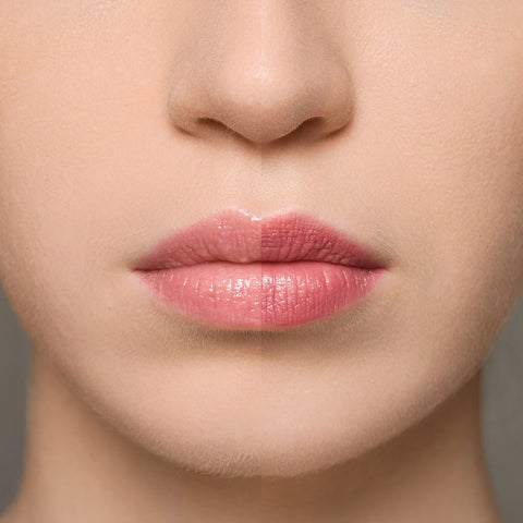 Chogan Supreme Lip Treatment – Strawberry